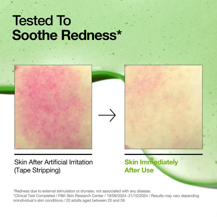 Azelaic Acid 10 Hyaluron Redness Soothing Serum (30ml)